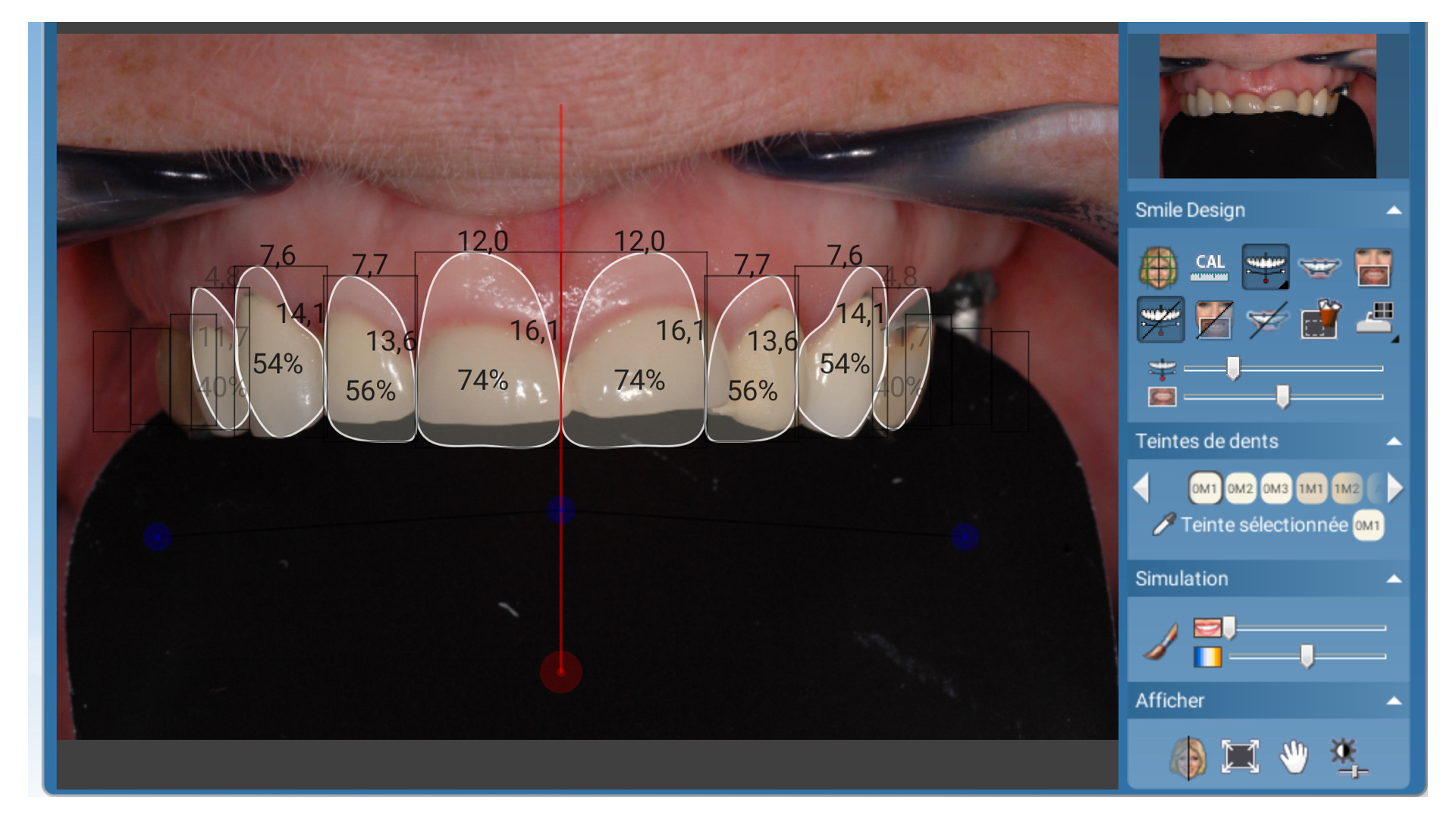 Les facettes de A à Z
